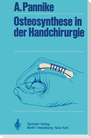 Osteosynthese in der Handchirurgie