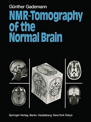 Gademann, Günther. NMR-Tomography of the Normal Brain. Springer Berlin Heidelberg, 2011.