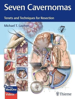 Lawton, Michael T.. Seven Cavernomas - Tenets and Techniques for Resection. Thieme Medical Publishers, 2026.