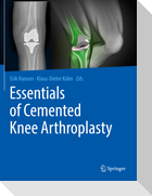 Essentials of Cemented Knee Arthroplasty