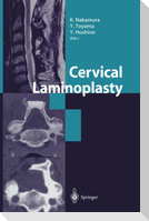Cervical Laminoplasty