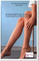 Krampfadern