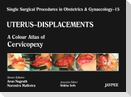 Single Surgical Procedures in Obstetrics and Gynaecology - Volume 15 - UTERUS - DISPLACEMENTS