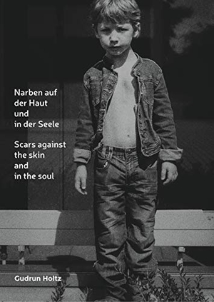 Holtz, Gudrun. Narben auf der Haut und in der Seele - Scars against the skin and the soul. Books on Demand, 2020.