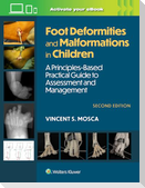 Foot Deformities and Malformations in Children