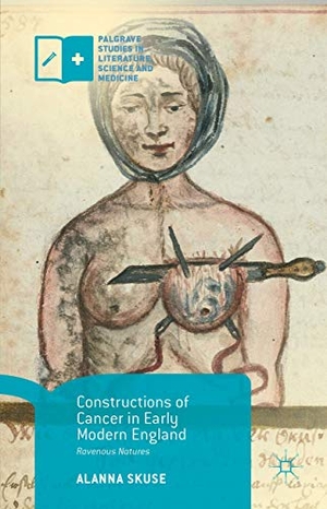 Skuse, Alanna. Constructions of Cancer in Early Modern England - Ravenous Natures. Palgrave MacMillan UK, 2015.