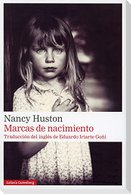 Marcas de Nacimiento