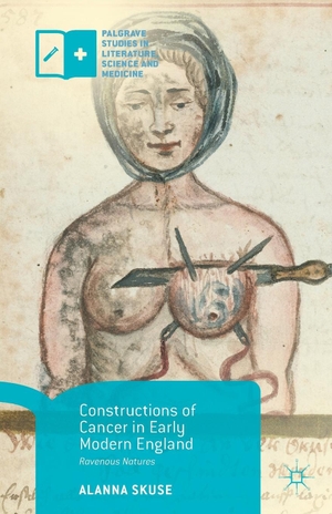 Skuse, Alanna. Constructions of Cancer in Early Modern England - Ravenous Natures. Springer Nature B.V., 2015.