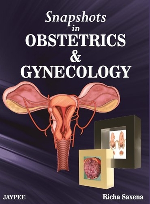 Saxena, Richa. Snapshots in Obstetrics and Gynaecology. Jaypee Brothers Medical Publishers Pvt Ltd, 2012.
