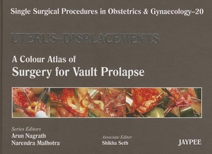 Nagrath, Arun / Malhotra, Narendra et al. Single Surgical Procedures in Obstetrics and Gynaecology - Volume 20 - UTERUS - DISPLACEMENTS - A Colour Atlas of Surgery for Vault Prolapse. Jaypee Brothers Medical Publishers Pvt Ltd, 2012.
