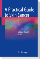 A Practical Guide to Skin Cancer