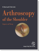 Arthroscopy of the Shoulder