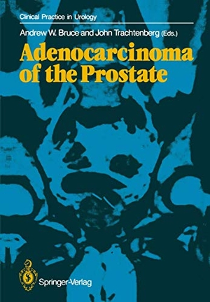 Trachtenberg, John / Andrew W. Bruce (Hrsg.). Adenocarcinoma of the Prostate. Springer London, 2011.