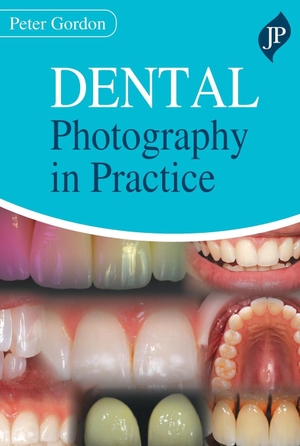 Gordon, Peter. Dental Photography in Practice. Jaypee Brothers Medical Publishers Pvt Ltd, 2020.