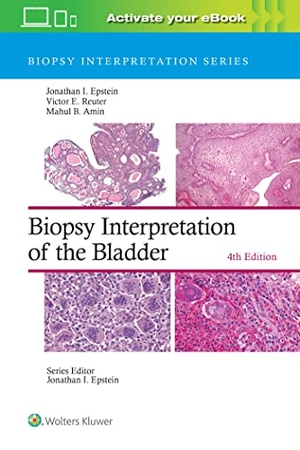 Epstein, Jonathan I. / Reuter, Victor E. et al. Biopsy Interpretation of the Bladder. Lippincott Williams&Wilki, 2023.