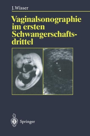 Wisser, Josef. Vaginalsonographie im ersten Schwangerschaftsdrittel. Springer Berlin Heidelberg, 2011.