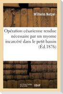 Opération Césarienne Rendue Nécessaire Par Un Myome Incarcéré Dans Le Petit Bassin