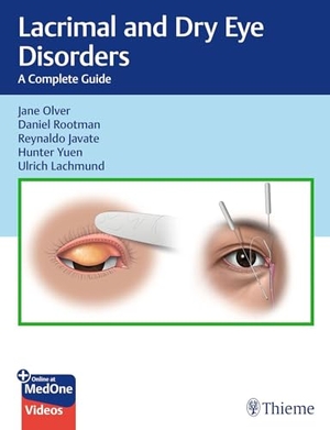 Olver, Jane / Rootman, Daniel et al. Lacrimal and Dry Eye Disorders - A Complete Guide. Thieme Medical Publishers, 2026.